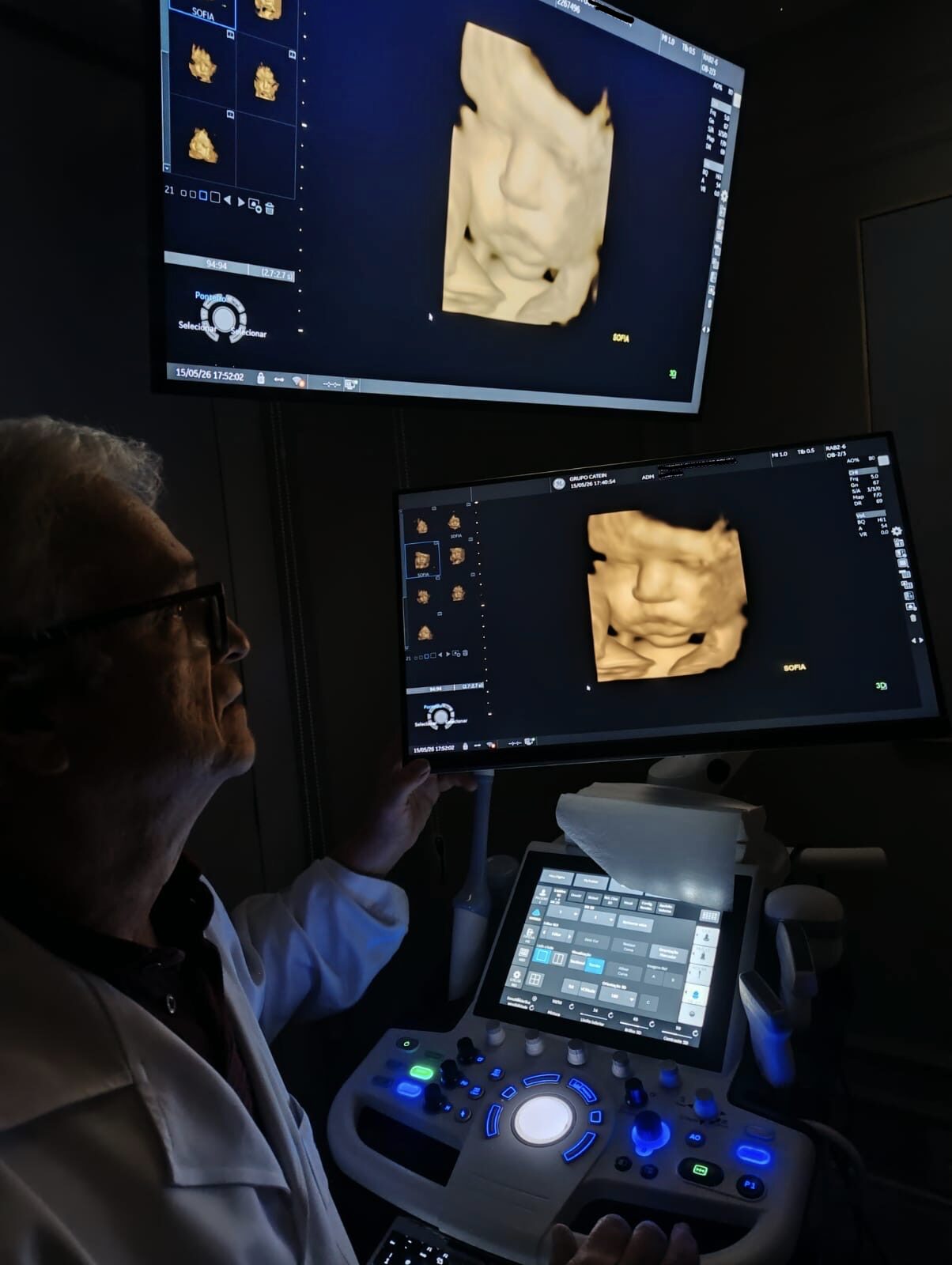 Aparelho de ultrassonografia 3D e 4D